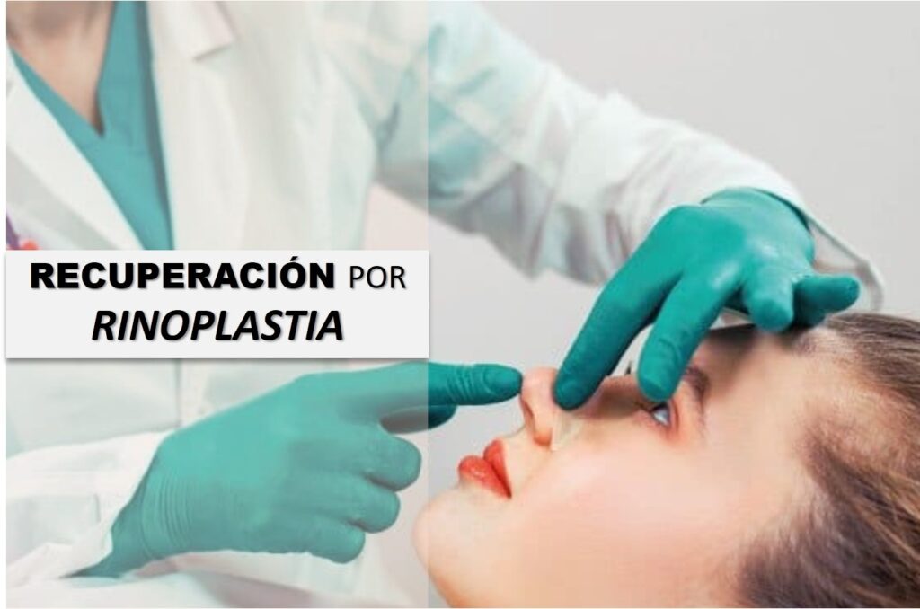 recuperacion por rinoplastia destacada