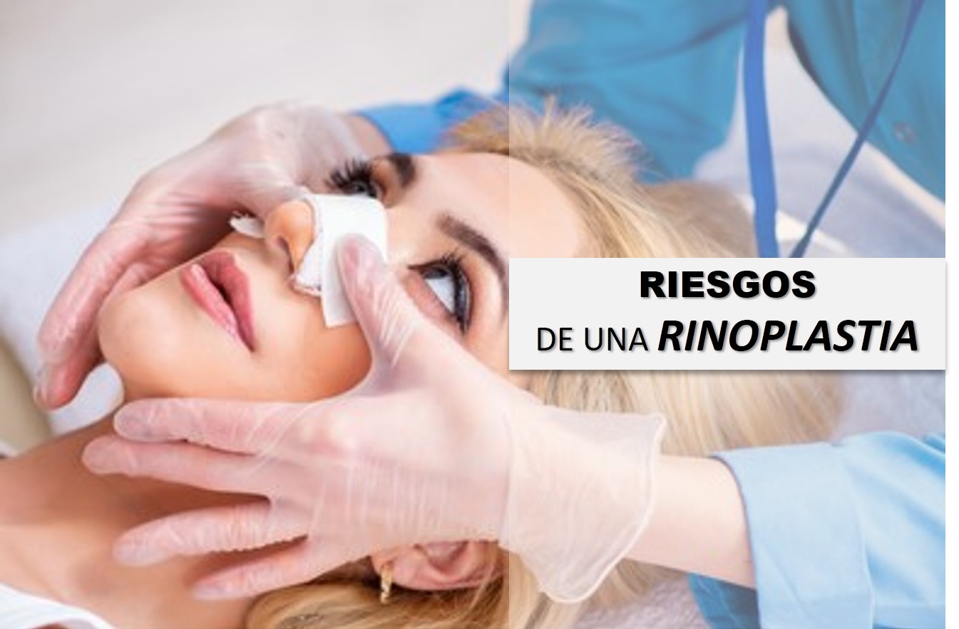 riesgos de una rinoplastia