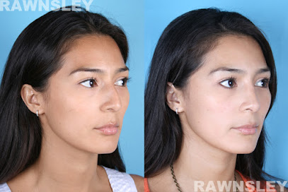 Rawnsley Plastic Surgery en Los Angeles Estado de Los Angeles